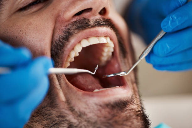Best Dentist for Tooth Abscess  in Gulfport, FL